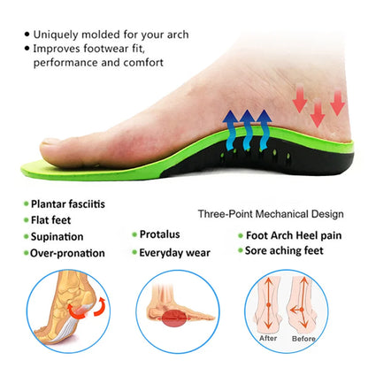 Orthopedic Insole Unisex Outdoor Hiking Travel Essentials X/o Leg Correction Flat Arch Support Sports High Elastic Cushion - Beri Collection 